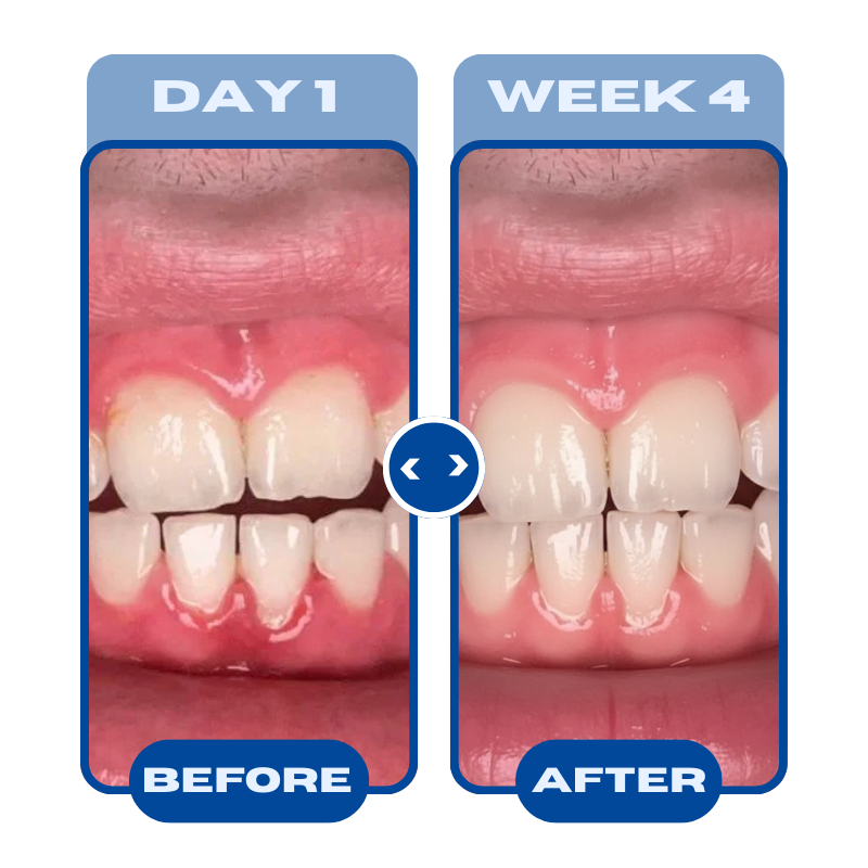 All-In-One Natural Oil Pulling Rinse