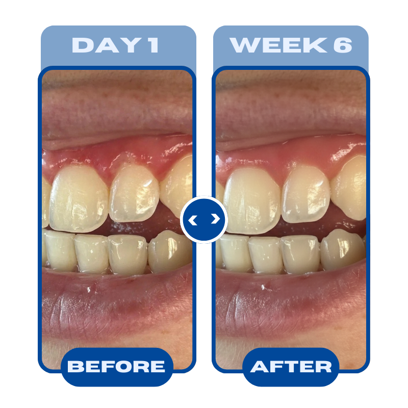 All-In-One Natural Oil Pulling Rinse