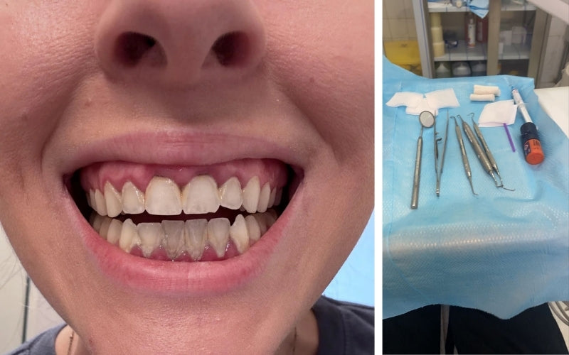Alt Image